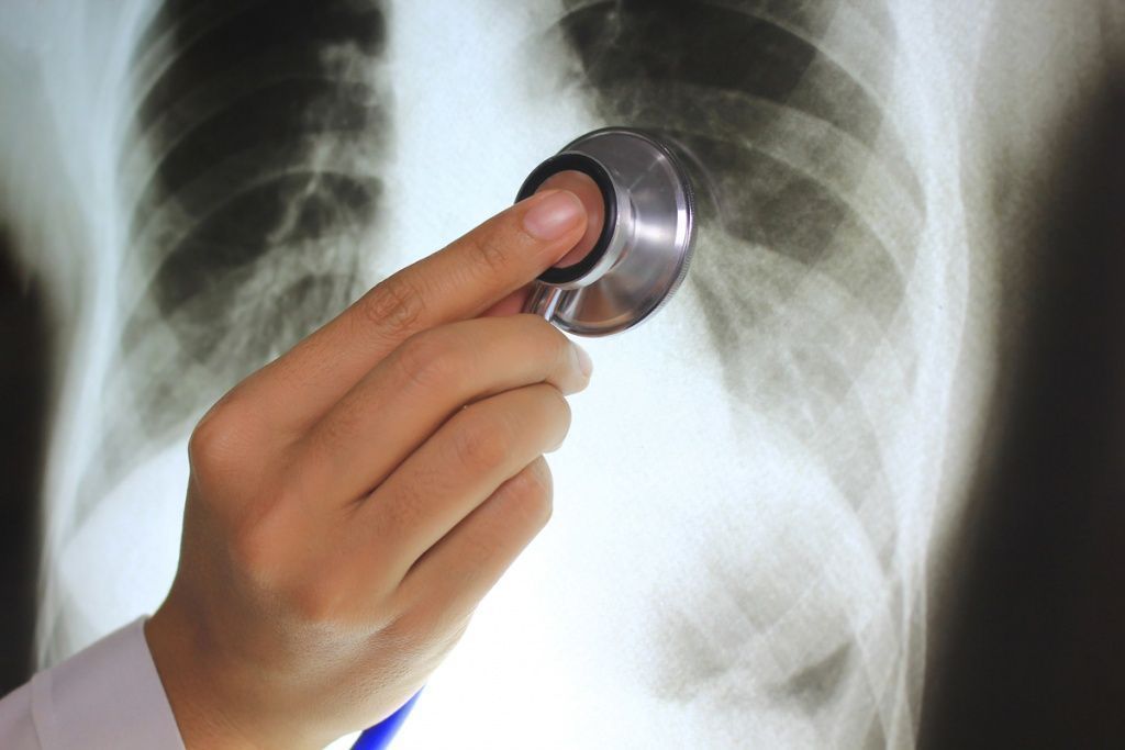 Tabaco y Silicosis por Quirón Prevención