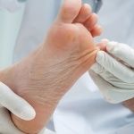 PREMAP.- Cómo prevenir los riesgos de la Hiperucemia