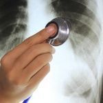Quirón Prevención.- Tabaco y Silicosis